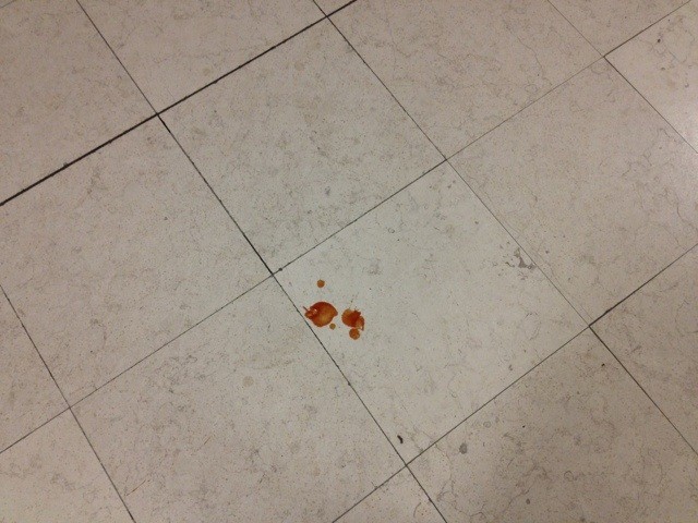 There Will be Blood. Or Ketchup.